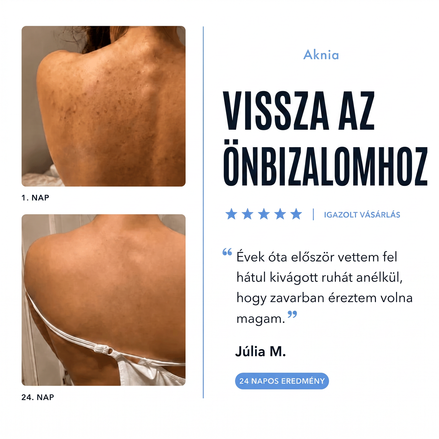 Aknia - Pattanás Elleni Gyógyszappan